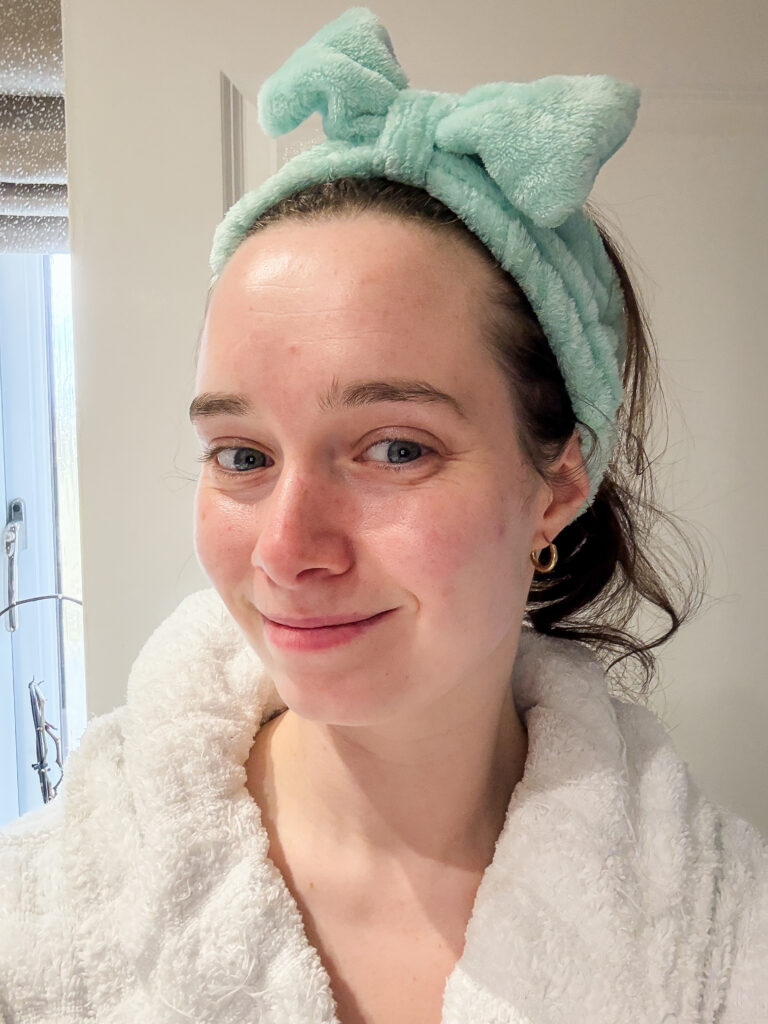 Bare skin immediately after removing the Medicube PDRN pink collagen gel mask, looking hydrated and refreshed