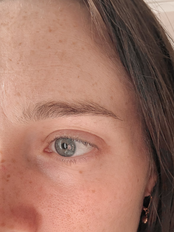 reduced fine lines after using medik8 crystal retinal 6 for 12 weeks
