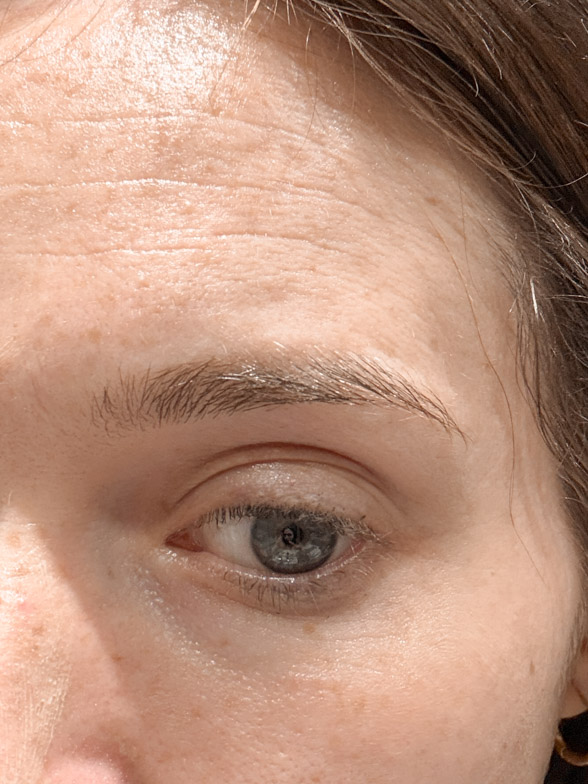 lines before using medik8 crystal retinal 6
